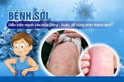 BÀI TUYÊN TRUYỀN VỀ  PHÒNG CHỐNG BỆNH SỞI
